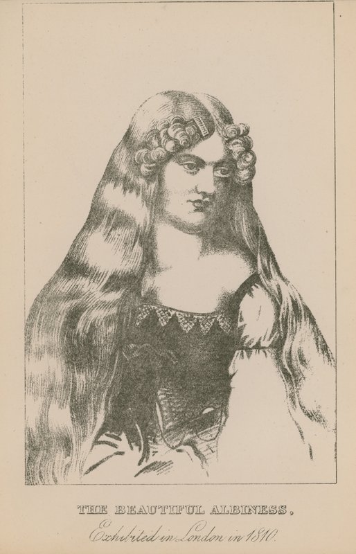 La bella albina, esposta a Londra nel 1810 da English School