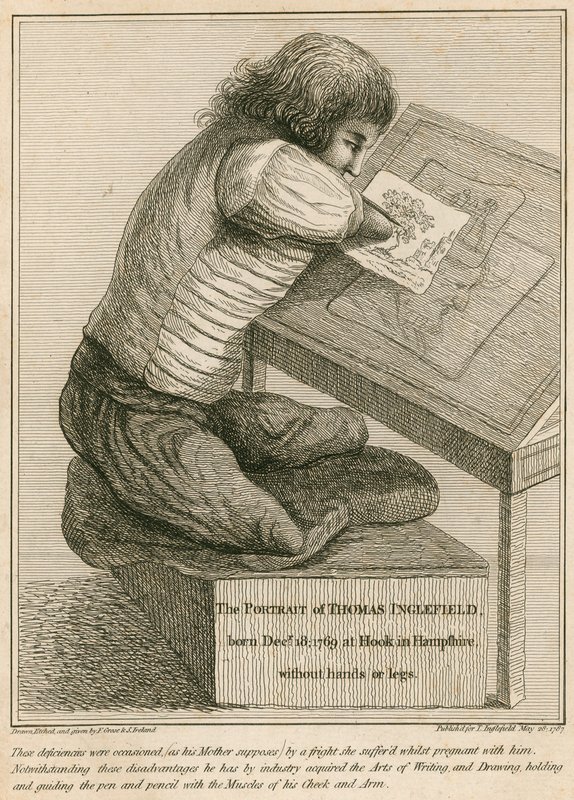 Thomas Inglefield, nato il 18 dicembre 1769 a Hook, Hampshire, senza braccia né gambe da English School