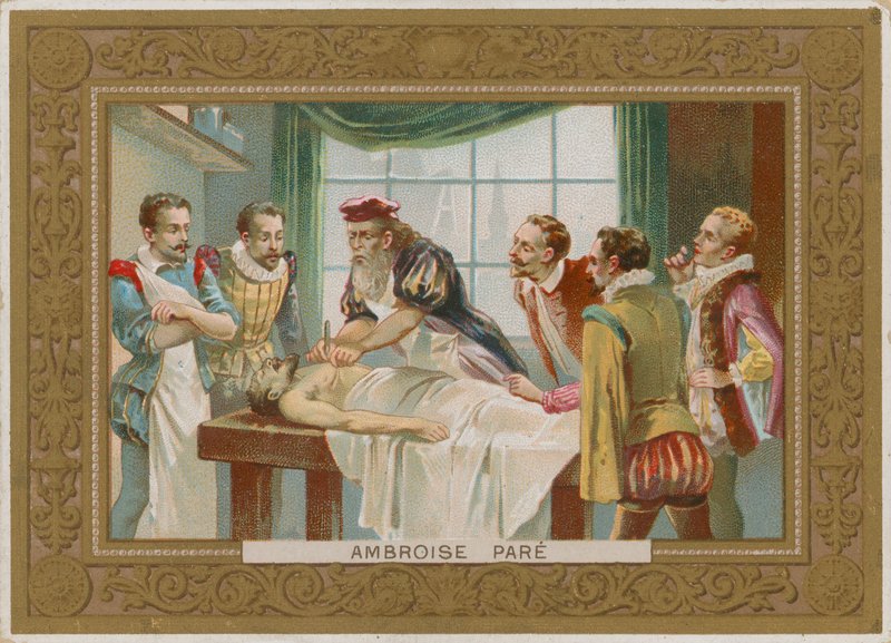 Ambroise Paré, chirurgo francese del XVI secolo da French School