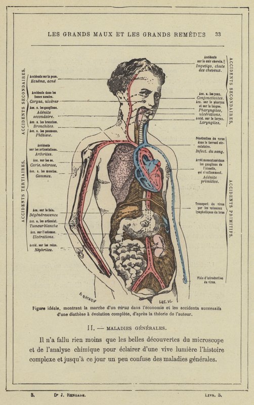 Figura ideale, che mostra il percorso di un virus nell