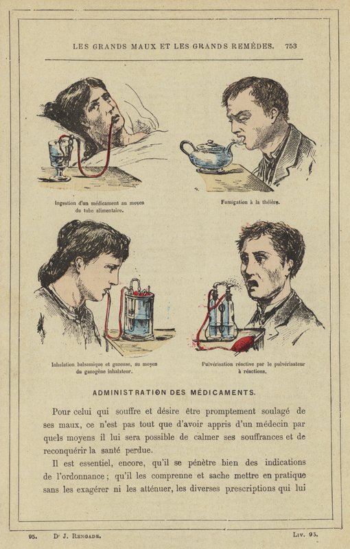 Ingestione di un medicinale mediante il tubo alimentare, fumigazione con la teiera, inalazione balsamica e gassosa, mediante l