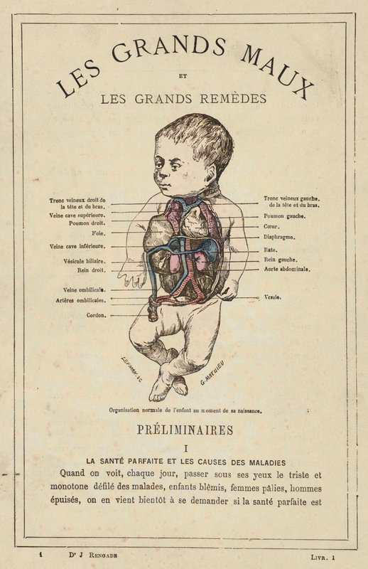 Organizzazione normale del bambino al momento della nascita da French School