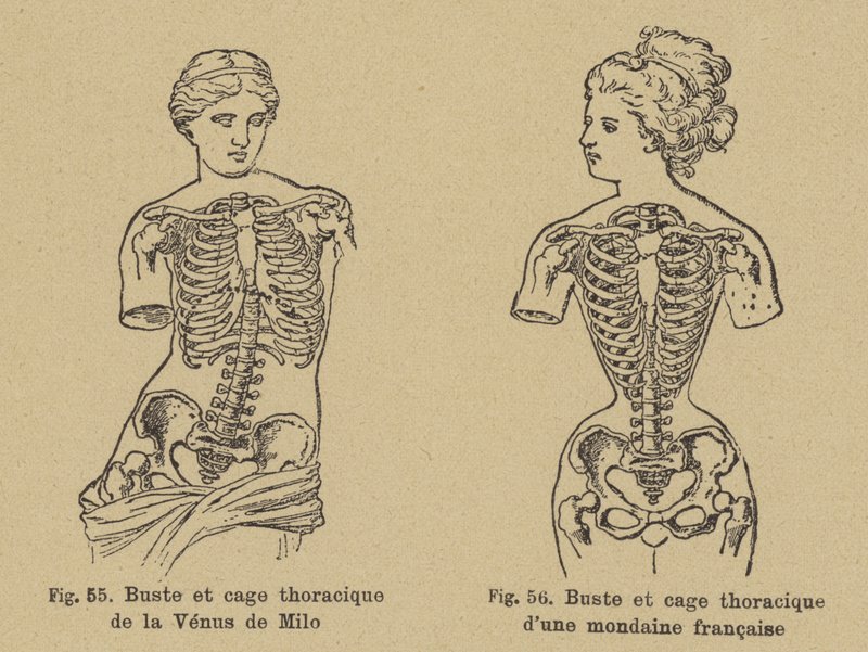 Confronto della forma del petto e della gabbia toracica della Venere di Milo con quella di una socialite francese di fine XIX secolo da German School