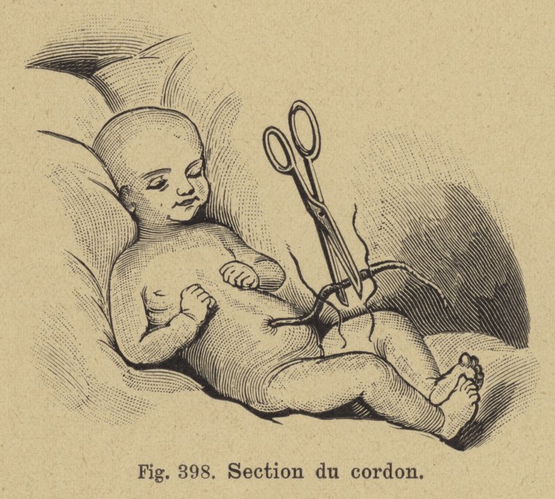 Taglio del cordone ombelicale di un neonato da German School