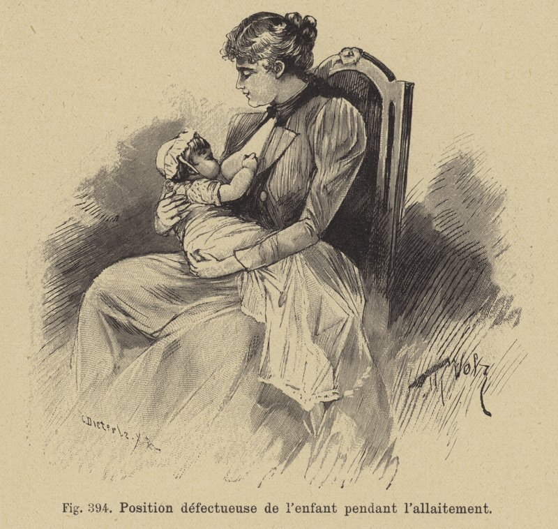 Posizione scorretta di un bambino durante l