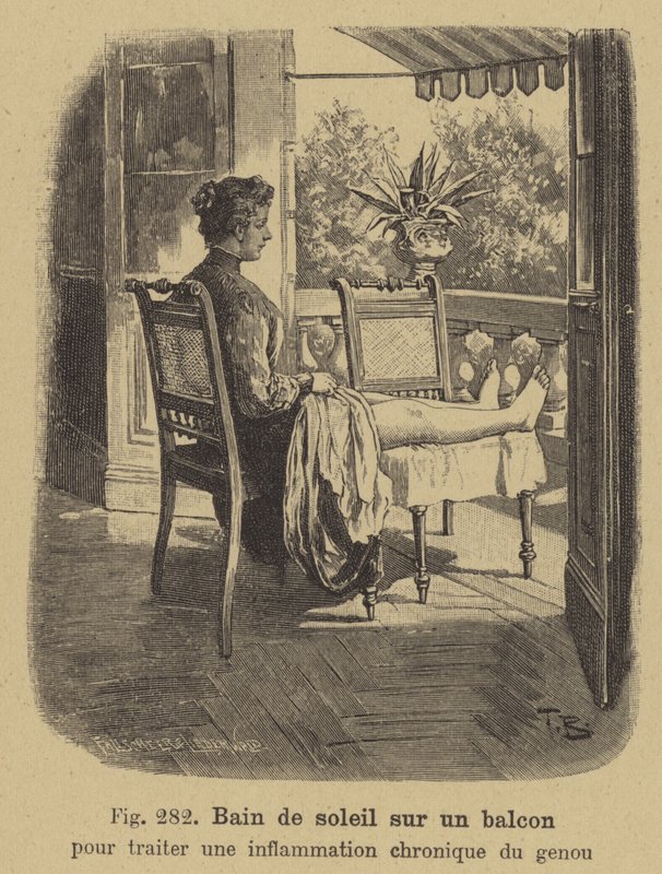 Prendere il sole su un balcone per trattare l