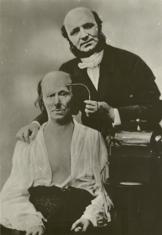 Il neurologo francese Duchenne de Boulogne utilizza il suo apparato di elettrofisiologia su un anziano da Guillaume Benjamin Armand Duchenne de Boulogne