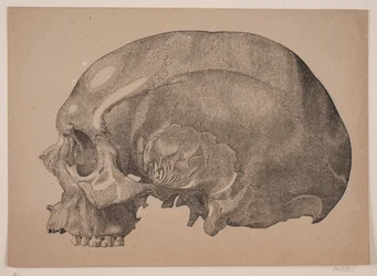 Cranio