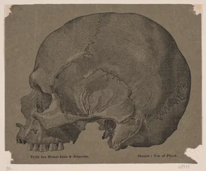 Cranio