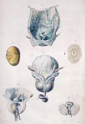 Malattie della vescica e della prostata, da 