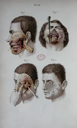 Tavola anatomica della mascella superiore