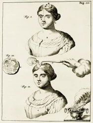 Trattamento di un epilettico, da Exercitationes Practicae circa Medendi Methodum di Frederik Dekkers, 1694