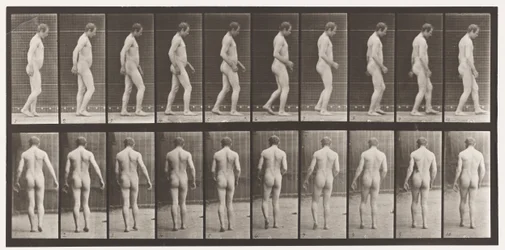 Dopo un trauma cranico; camminare