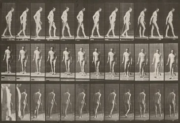 Tavola numero 559. Paraplegia parziale, camminare con un bastone