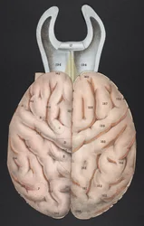 Una sezione del cervello, da 