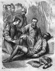 Ambroise Paré, chirurgo francese