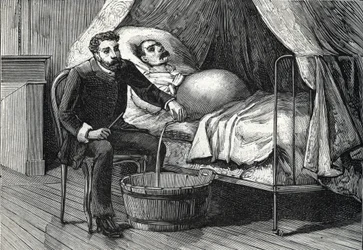 Paziente con cirrosi epatica avanzata, medico che esegue una puntura (incisione) 1888