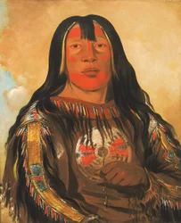 Peh-tó-pe-kiss, Costole d