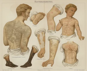 Disturbi della pelle