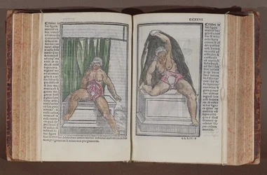 Anatomia femminile, da Commentaria cum amplissimis additionibus super anatomiam mundini, di Jacopo Berengario da Carpi (c.1460-c.1530) pubblicato a Bologna, 1521 (xilografia a colori)