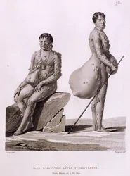 Isole Marianne Settentrionali: Due uomini che soffrono di tubercolosi, da 