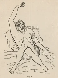 Epilepsia isterica, attacco, contorsioni, fig. 1 da 
