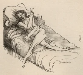 Epilepsia isterica, attacco, contorsioni, fig. 3 da 