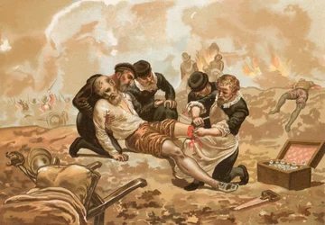 Ambroise Pare, che introdusse la legatura delle arterie