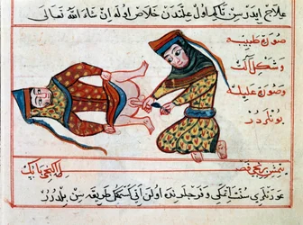 Medicina: operazione di un ermafrodito. Miniatura da un trattato di medicina turca di Sharaf al-din