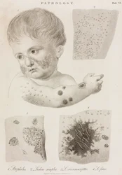 Dermatologia Tipi di malattie della pelle