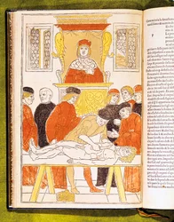 Lezione di anatomia a Padova, Italia, 1483