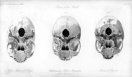 Base del cranio