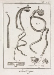Chirurgia oculare dell