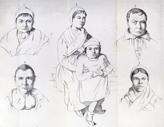 Considerazioni sulle cause del cretinismo endemico di Morel