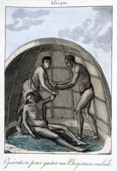 Operazione per curare un Bojesmen - incisione