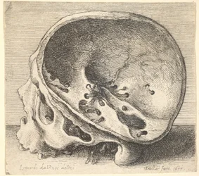 Teschio sezionato in profilo a sinistra con il lato sinistro del cranio rimosso, 1651